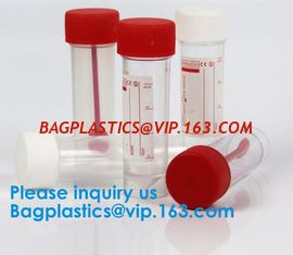 China Disposable Urine Specimen Cup/Urine Sample Containers/Urine Collection Cup,Sterile Disposable Hospital Sample 60ml 100 supplier
