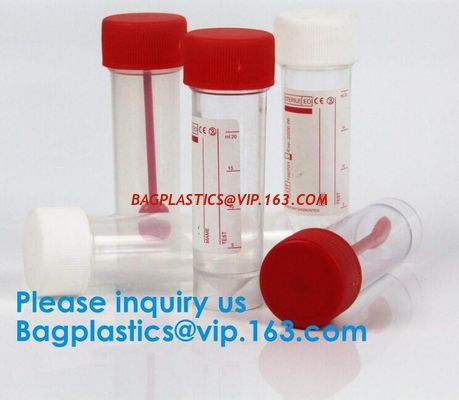 China Disposable Urine Specimen Cup/Urine Sample Containers/Urine Collection Cup,Sterile Disposable Hospital Sample 60ml 100 factory